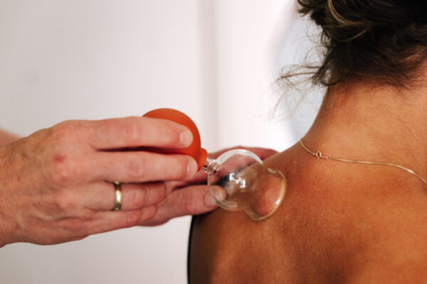 Praxisfotos Dr. E. Seidel - Juli 2026-117 Schröpftherapie mit einem Glas-Schröpfglas